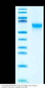 Cynomolgus MADCAM1 Protein (MCM-CM101)
