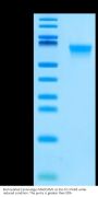 Biotinylated Cynomolgus MADCAM1 Protein (MCM-CM401B)