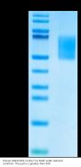 Human MADCAM1 Protein (MCM-HM101)