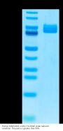 Human MADCAM1 Protein, Ultra Low Endotoxin (MCM-HM201-UL)