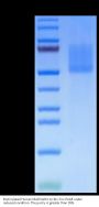 Biotinylated Human MADCAM1 Protein (MCM-HM401B)