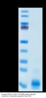 Human MCP-1/CCL2 Protein (MCP-HM401)