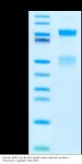 Human HGF R/c-MET Protein (MET-HM101)