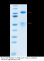 Human HGF R/c-MET Protein (MET-HM401)