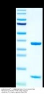 Human HLA-A*11:01&B2M&KRAS WT (VVVGAGGVGK) Monomer Protein (MHC-HE001)