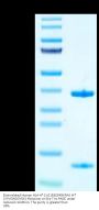 Biotinylated Human HLA-A*11:01&B2M&KRAS WT (VVVGAGGVGK) Monomer Protein (MHC-HE001B)