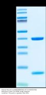 Human HLA-A*11:01&B2M&KRAS WT (VVGAGGVGK) Monomer Protein (MHC-HE002)