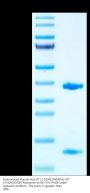 Biotinylated Human HLA-A*11:01&B2M&KRAS WT (VVGAGGVGK) Monomer Protein (MHC-HE002B)