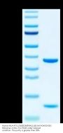 Human HLA-A*11:01&B2M&RASL11B (AVVGASGVGK) Monomer Protein (MHC-HE003)