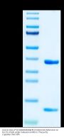 Human HLA-A*11:01&B2M&RAB7B (IVGAIGVGK) Monomer Protein (MHC-HE004)