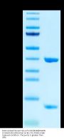 Biotinylated Human HLA-A*11:01&B2M&RAB7B (IVGAIGVGK) Monomer Protein (MHC-HE004B)