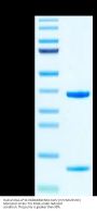 Human HLA-A*11:01&B2M&KRAS G12V (VVVGAVGVGK) Monomer Protein (MHC-HE005)