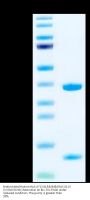 Biotinylated Human HLA-A*11:01&B2M&KRAS G12V (VVGAVGVGK) Monomer Protein (MHC-HE006B)