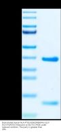 Biotinylated Human HLA-A*02:01&B2M&KRAS G12V (KLVVVGAVGV) Monomer Protein (MHC-HE007B)