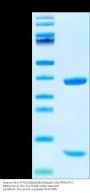 Human HLA-A*02:01&B2M&CMVpp65 (NLVPMVATV) Monomer Protein (MHC-HE013)