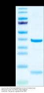 Human HLA-A*03:01&B2M&KRAS G12D (VVVGADGVGK) Monomer Protein (MHC-HE014)