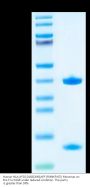 Human HLA-A*02:01&B2M&AFP (FMNKFIYEl) Monomer Protein (MHC-HE017)