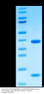 Human HLA-A*02:01&B2M&PLK1 (AAPGAPAAA) Monomer Protein (MHC-HE027)