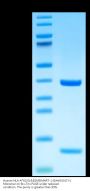 Human HLA-A*02:01&B2M&MART-1 (EAAGIGILTV) Monomer Protein (MHC-HE034)