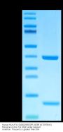 Human HLA-A*11:01&B2M&EGFR L858R (KITDFGRAK) Monomer Protein (MHC-HE039)