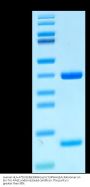 Human HLA-A*02:01&B2M&Foxp3 (TLIRWAILEA) Monomer Protein (MHC-HE041)