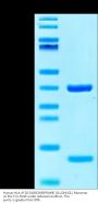 Human HLA-A*02:01&B2M&PRAME (SLLQHLIGL) Monomer Protein (MHC-HE045)