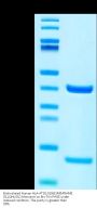 Biotinylated Human HLA-A*02:01&B2M&PRAME (SLLQHLIGL) Monomer Protein (MHC-HE045B)