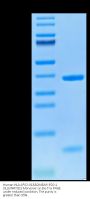 Human HLA-A*02:01&B2M&NY-ESO-1 (SLLMWITQC) Monomer Protein (MHC-HE446)