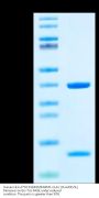 Human HLA-A*02:01&B2M&NPM1-CLAV (CLAVEEVSL) Monomer Protein (MHC-HE450)