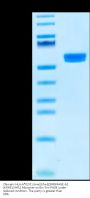 Chimeric HLA-A*02:01 (mα3) &mB2M&MAGE-A2 (KMVELVHFL) Monomer Protein (MHC-HM104)