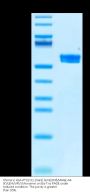 Chimeric HLA-A*02:01 (mα3) &mB2M&MAGE-A4 (KVLEHVVRV) Monomer Protein (MHC-HM106)
