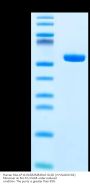 Human HLA-A*11:01&B2M&KRAS G12D (VVVGADGVGK) Monomer Protein (MHC-HM120)