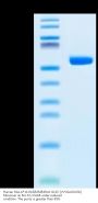 Human HLA-A*11:01&B2M&KRAS G12C (VVVGACGVGK) Monomer Protein (MHC-HM139)