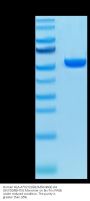 Human HLA-A*02:01&B2M&MAGE-A4 (GVYDGREHTV) Monomer Protein (MHC-HM401)