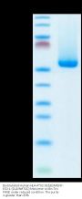 Biotinylated Human HLA-A*02:01&B2M&NY-ESO-1 (SLLMWITQC) Monomer Protein (MHC-HM405B)