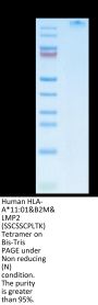 Human HLA-A*11:01&B2M&LMP2 (SSCSSCPLTK) Tetramer Protein (MHC-HM410T)