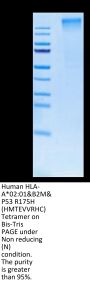 Human HLA-A*02:01&B2M&P53 R175H (HMTEVVRHC) Tetramer Protein (MHC-HM415T)