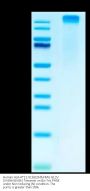 Human HLA-A*11:01&B2M&KRAS G12V (VVGAVGVGK) Tetramer Protein (MHC-HM422T)