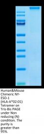 Human&Mouse Chimeric NY-ESO-1 (HLA-A*02:01) Tetramer Protein (MHC-HM424T)