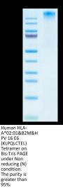 Human HLA-A*02:01&B2M&HPV 16 E6 (KLPQLCTEL) Tetramer Protein (MHC-HM436T)