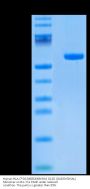 Human HLA-C*03:04&B2M&KRAS G12D (GADGVGKSAL) Monomer Protein (MHC-HM438)