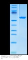 Biotinylated Human HLA-C*03:04&B2M&KRAS G12D (GADGVGKSAL) Monomer Protein (MHC-HM438B)