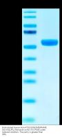 Biotinylated Human HLA-A*02:01&B2M&PRAME (ALYVDSLFFL) Monomer Protein (MHC-HM447B)