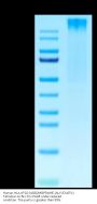 Human HLA-A*02:01&B2M&PRAME (ALYVDSLFFL) Tetramer Protein (MHC-HM447T)