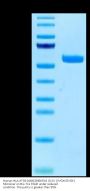 Human HLA-A*03:01&B2M&KRAS G12V (VVGAVGVGK) Monomer Protein (MHC-HM456)