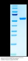 Human HLA-A*02:01&B2M&CMV pp65 (NLVPMVATV) Monomer Protein (MHC-HM458)