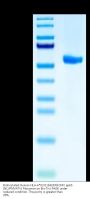 Biotinylated Human HLA-A*02:01&B2M&CMV pp65 (NLVPMVATV) Monomer Protein (MHC-HM458B)