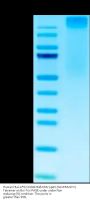 Human HLA-A*02:01&B2M&CMV pp65 (NLVPMVATV) Tetramer Protein (MHC-HM458T)