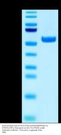 Biotinylated Human HLA-A*02:01&B2M&MAGE-A2 (KMVELVHFL) Monomer Protein (MHC-HM460B)