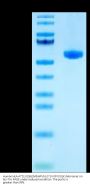 Human HLA-A*11:01&B2M&HPV16 E7 (IVCPICSQK) Monomer Protein (MHC-HM464)